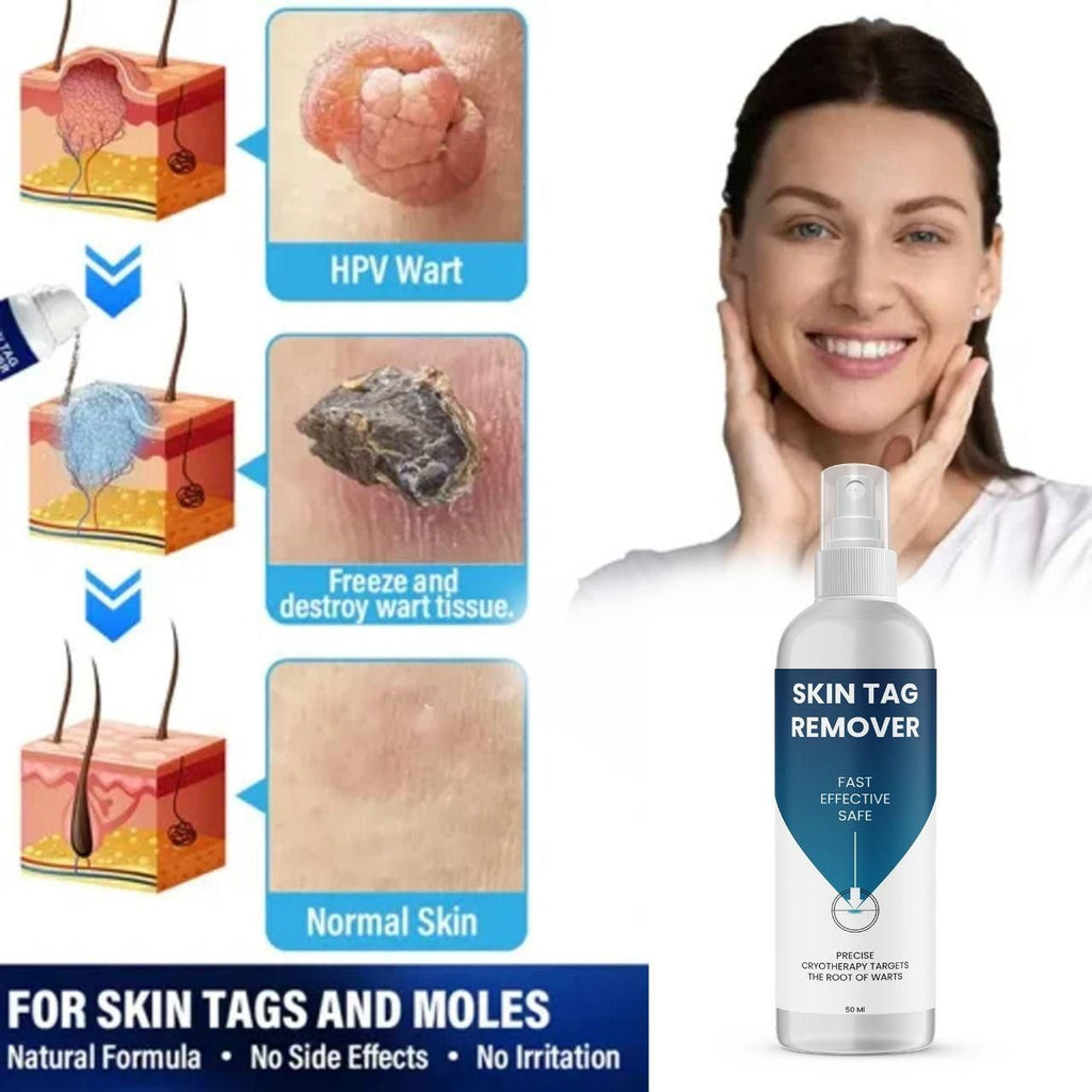 Skin Tag Remover 100 ml Pack of 2